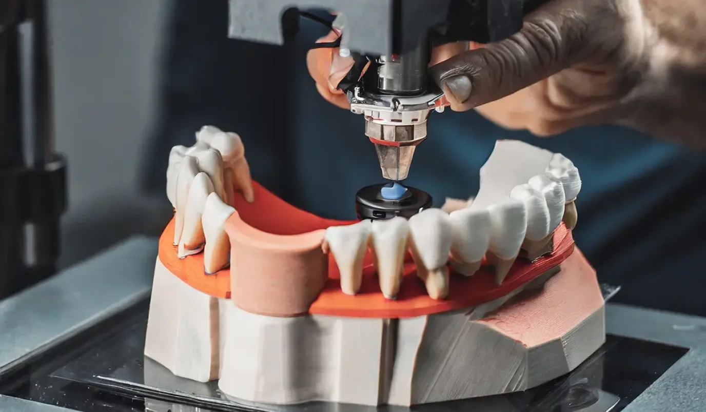 A 3D printer works precisely on a realistic tooth model and is probably used to produce dental prostheses or implants.